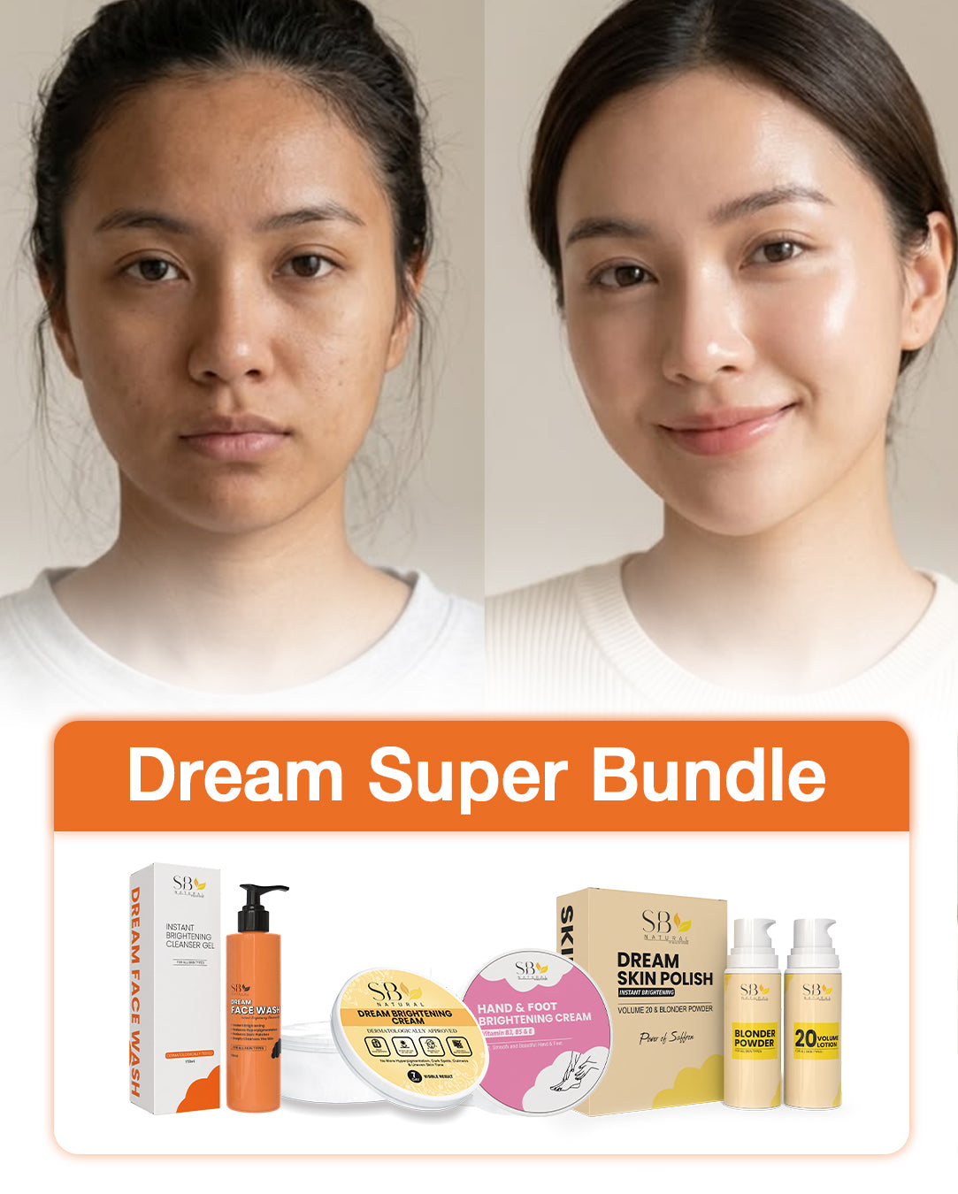 Super Bundle